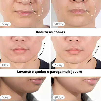 Masajeador Reductor Arrugas y papada con 3 luz Led RECARGABLE